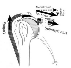 Diagram explaining Force couple of Cuff tear arthropathy